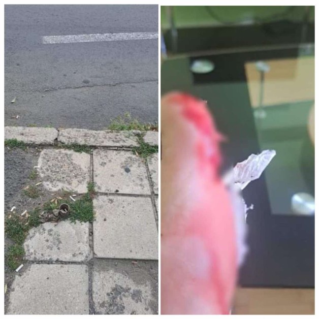 Жена си цепна пръста на крака на желязо, кой е отговорен?  СНИМКИ