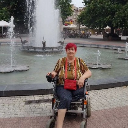 Пловдивчанка се нуждае от подкрепа за закупуване на протези Жената