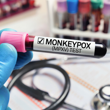 Инфекция с новия вариант на маймунската шарка mpox е открита за първи