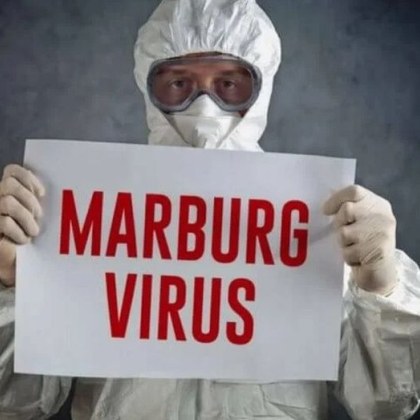 В Руанда вирусът Марбург известен като кървящо око поради един