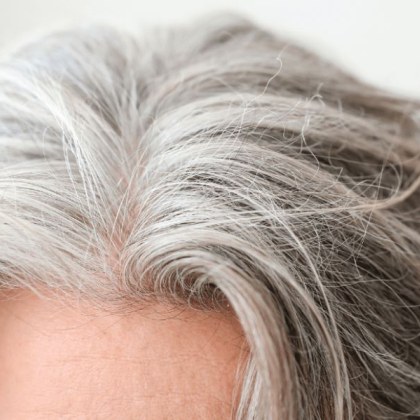 Побелялата коса подобно на фините бръчици по лицето или болките