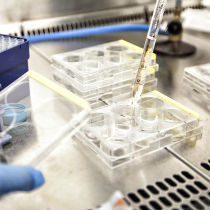 В София е регистриран случай на маймунска вариола Това показват