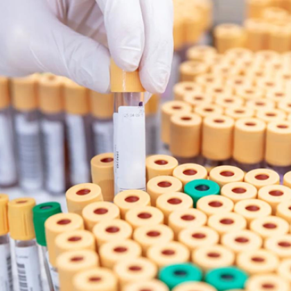 Стотици епруветки съдържащи смъртоносни вируси са изчезнали от лаборатория в