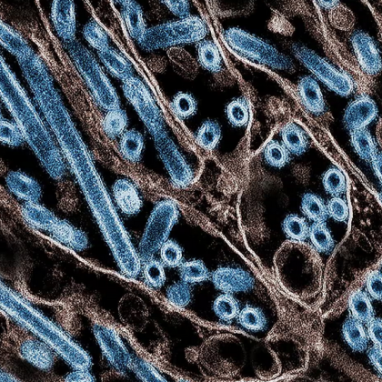 В САЩ е регистриран първият смъртен случай на човек от