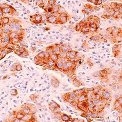 Скорошно проучване на учени от Mass General Brigham Clinic е