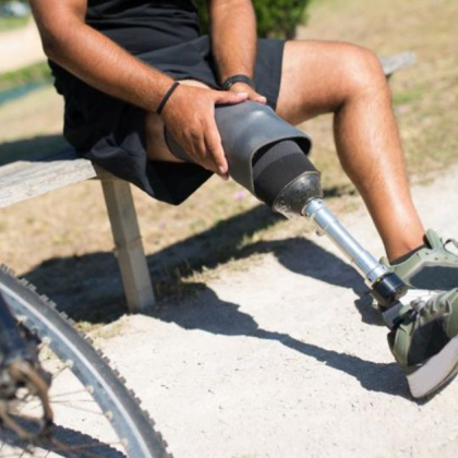 Мъж откраднал три ампутирани крака от болница Кантакузино в Букурещ