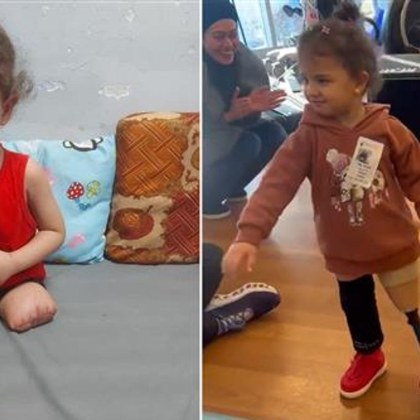 Лекари в Америка похвалиха тригодишно момиче от Газа което ходи