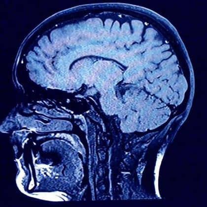 Учени разгледаха как смъртта влияе върху човешкия мозък и това