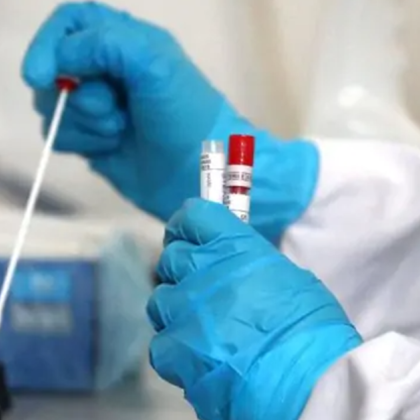 Международният комитет на Червения кръст МКЧК предупреди днес за риск