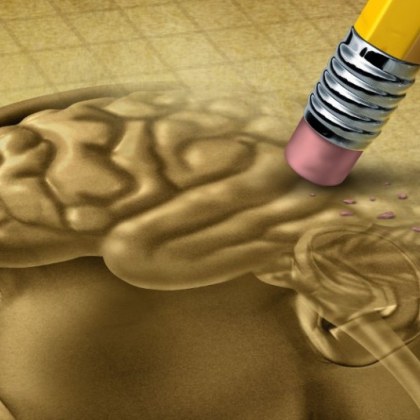 В свободен разговор обикновено използваме термините болест на Алцхаймер и