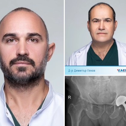 Коксартрозата или остеоартрит на тазобедрената става е дегенеративно заболяване което