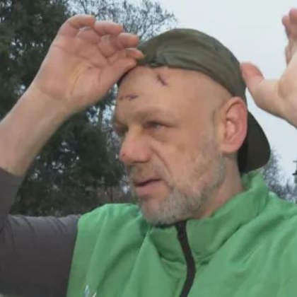 Ветеринарен лекар от Димитровград бе нападнат и бит с метална