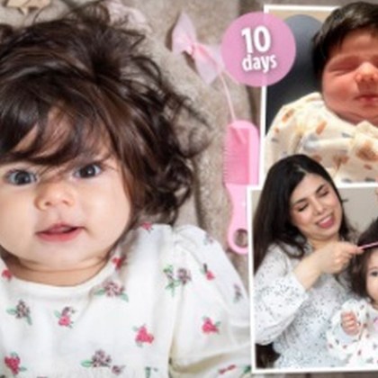 Момиченце се е родило с толкова много коса че непознати често