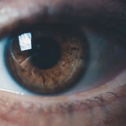 Синдромът на Антон е рядко неврологично разстройство което предизвиква объркване