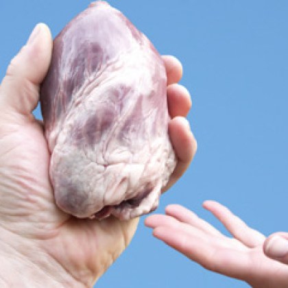 В търсене на решение на острия недостиг на човешки органи