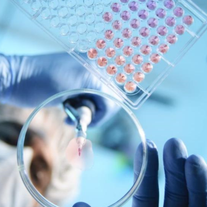 В Плевен се наблюдава увеличение на случаите на варицела основно