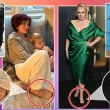 Откриха още един страничен ефект на Ozempic. Кои звезди показват признаци?