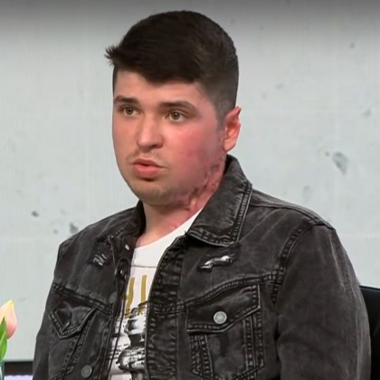 20 годишният доброволец Светослав Димитров пострада при пожара в Сакар планина