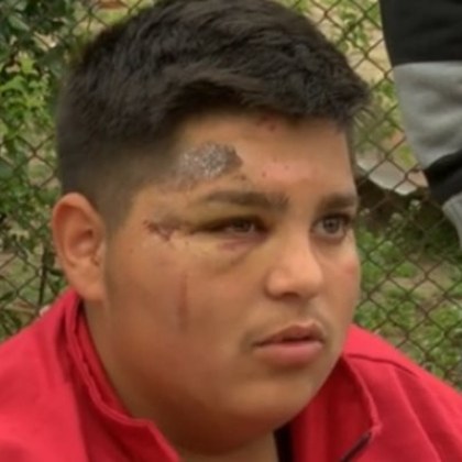 Задържан е шофьорът блъснал с висока скорост 15 годишно дете каза