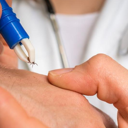 В сезона на кърлежите носенето на шапка блуза с дълъг