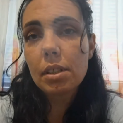 Пореден пътен инцидент с тротинетка в Плевен Блъснато е двегодишно