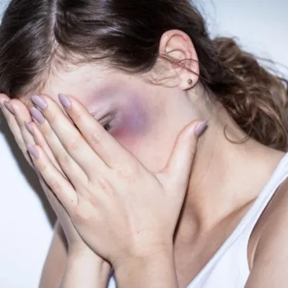 Софийската районна прокуратура повдигна обвинение на 36 годишен мъж за нанесена