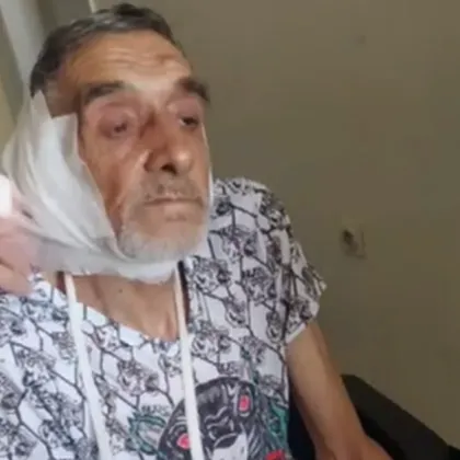 Мъж е в болница след като е пребит с лопата