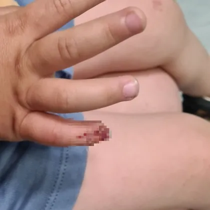 Инцидент на детска площадка в столичния квартал Хаджи Димитър предизвика