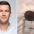 Лекари от Пловдив спасиха пациент след заседнала костилка в хранопровода