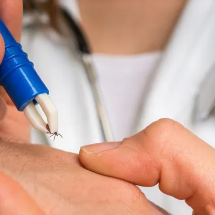 Жителка на Самоков алармира за наличие на кърлежи в района на