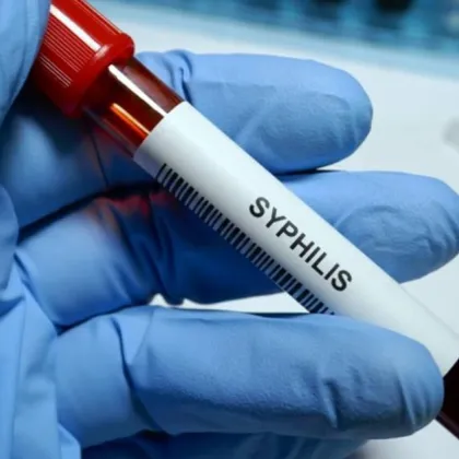 Случай на вроден сифилис са регистрирали от Регионалната здравна инспекция РЗИ в Плевен Това