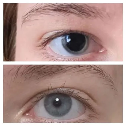 Британка публикува снимка на собствените си очи в социалната мрежа