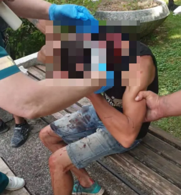 Брутален побой в Монтана: Ранена жена чака линейка половин час