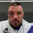 Георги Валентинов, отхапал ухото на съперник, с първи коментар