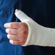 Непълнолетно момче скри наркотици в гипса на ръката си