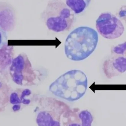 Един от най опасните микроорганизми на Земята Naegleria fowleri заслужено е