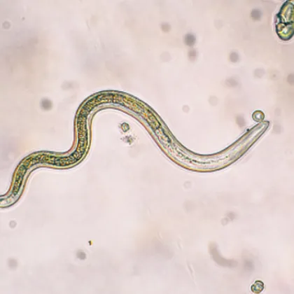 Властите в САЩ съобщават че е потвърден първият случай на