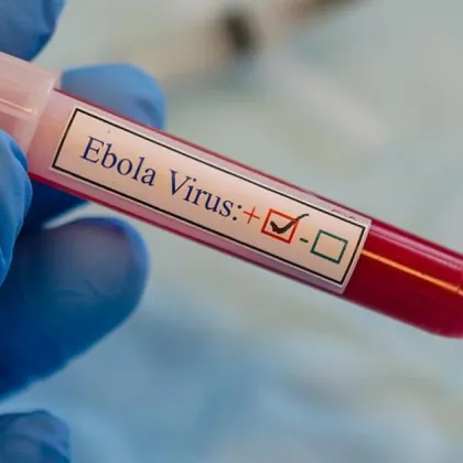 Властите в Демократична република Конго обявиха ново огнище на ебола