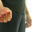Задържаха двама за побой на мъж пред дискотека в Павликени