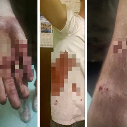 Семейство украинци живеещи във Варна преживяха кошмарна случка Три питбула