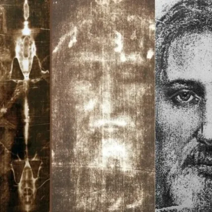 Стоматолог видя доказателство за Възкресението върху Торинската плащаница
