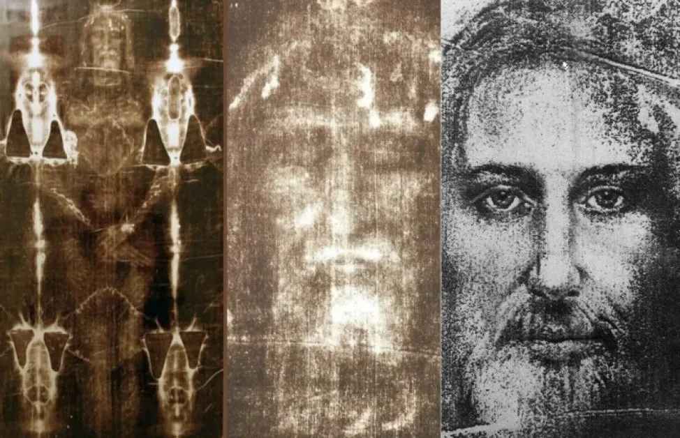 Стоматолог видя доказателство за Възкресението върху Торинската плащаница