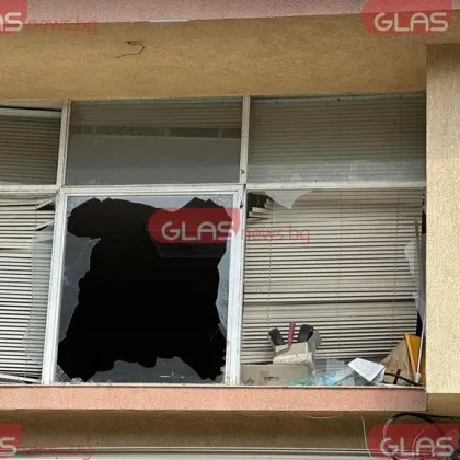 58 годишна жена с изгаряния от втора степен по цялото тяло се