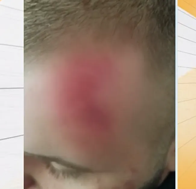 Година след жестокия побой в центъра на Пловдив: 21-годишен младеж още чака справедливост