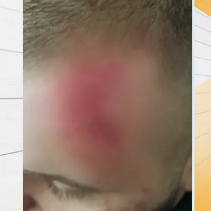 Година след като зверски беше пребит по погрешка в центъра