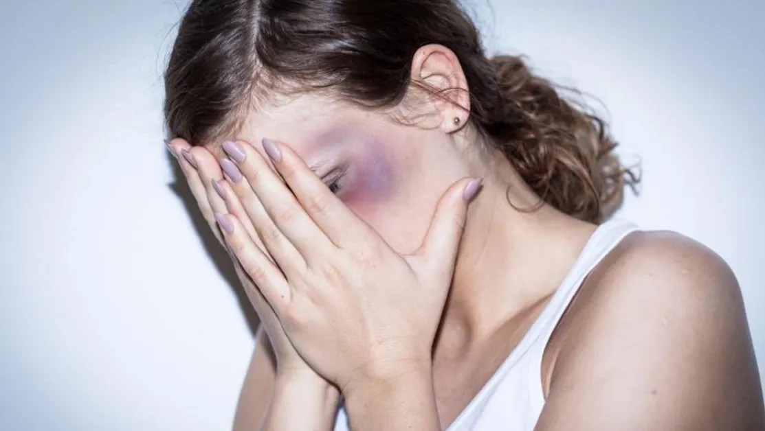 Предават на съд мъж, опитал да удуши бившата си пред детето им в Козлодуй