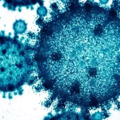 Откриха 9 случая на смъртоносния вирус Марбург, СЗО предупреди