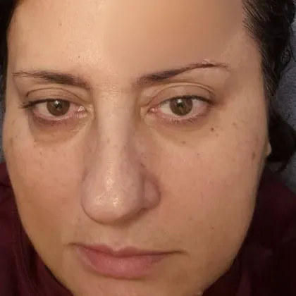 Заместник председателката на Общинския съвет ОбС в Плевен Наталия Цанева претърпя