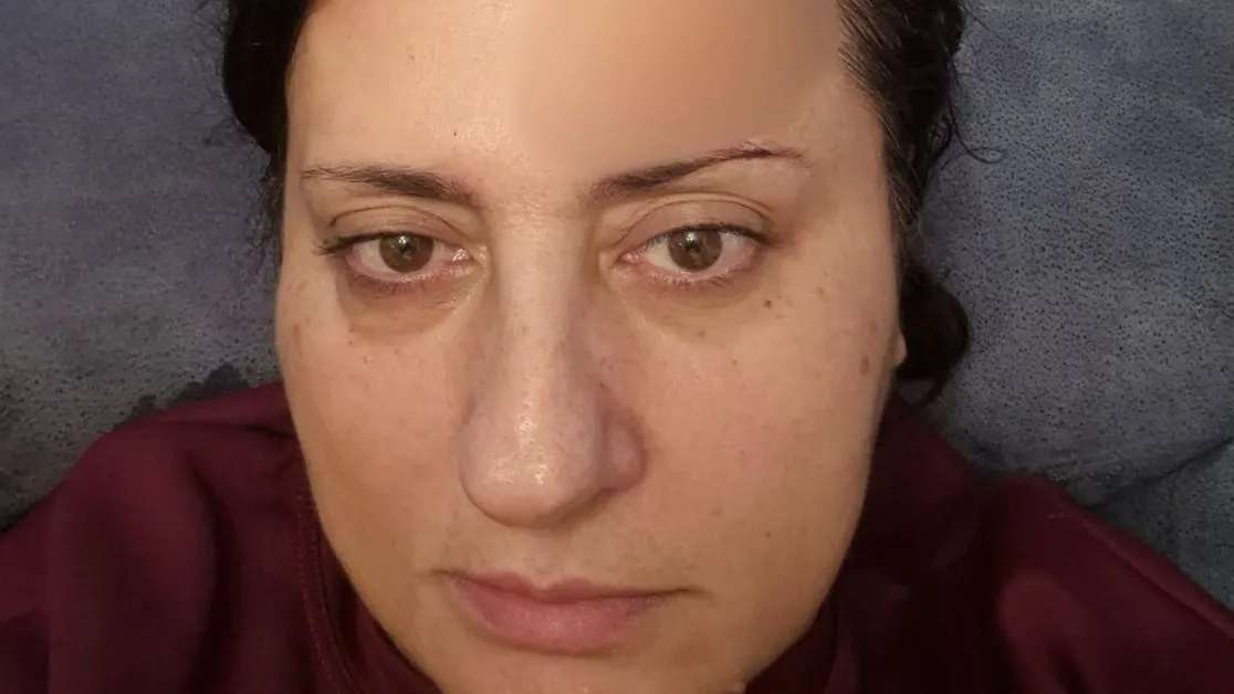 В дискотека: Стъклен предмет полетя към лицето на зам.-председателя на ОбС в Плевен СНИМКА