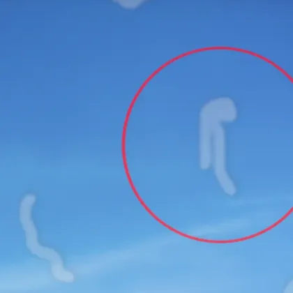 Защо виждаме „петна" и движещи се точки в зрението си?